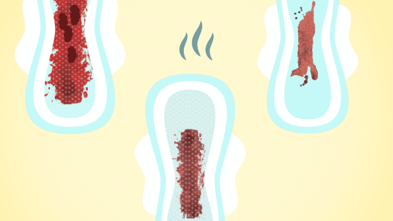 Coágulo na menstruação: 7 possíveis causas + como tratar
